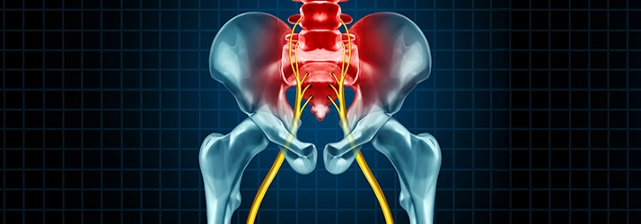 Can a Chiropractor Provide Relief for Sciatica in Gresham OR?
